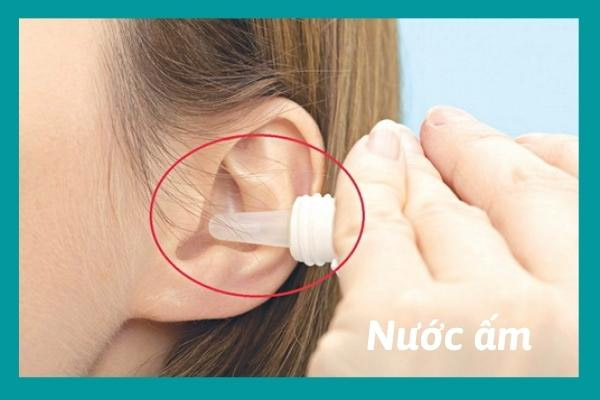 Giảm ngứa tai trái hiệu quả bằng cách nhỏ nước ấm vào tai